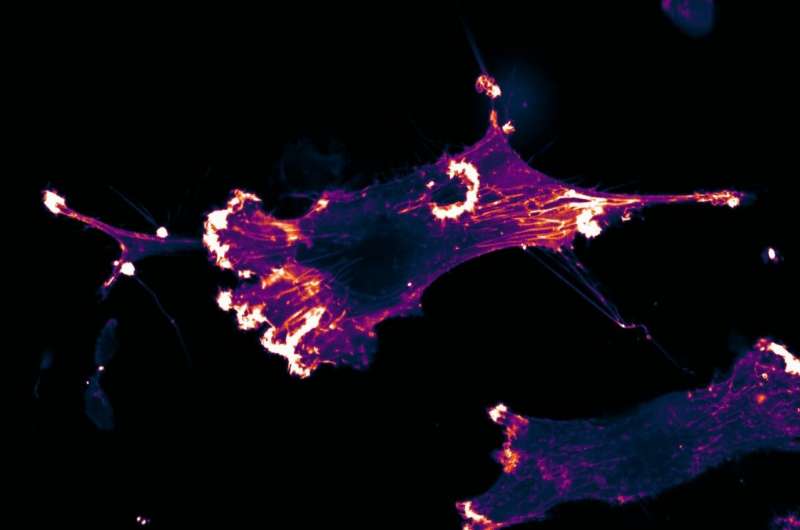 Forscher identifizieren Zellkommunikationsweg, der das Zellwachstum und das Überleben steuert
