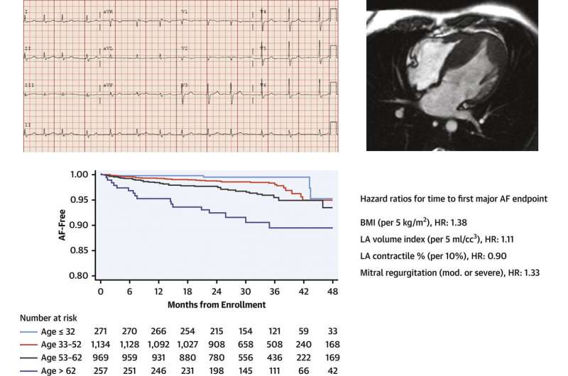 ID studi faktor risiko detak jantung tidak teratur pada pasien kardiomiopati hipertrofik