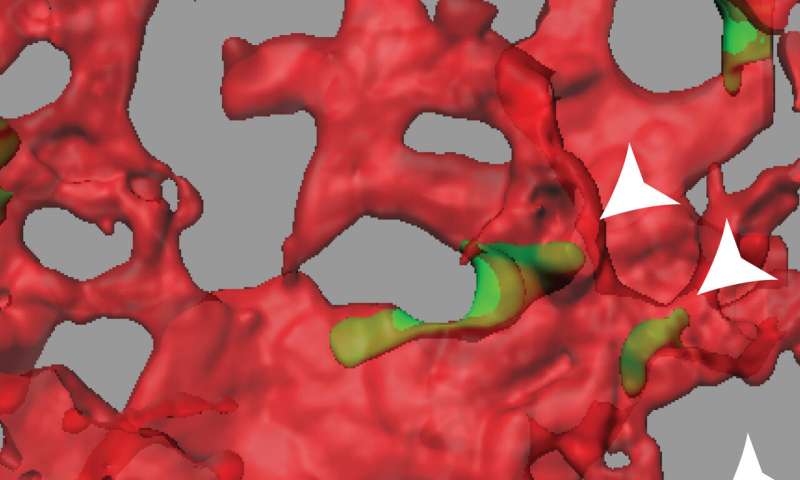 Proteinele par să prevină răspândirea celulelor tumorale prin vasele de sânge