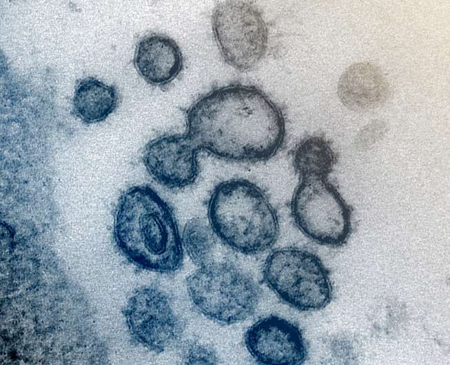 koronavirusas (COVID-19