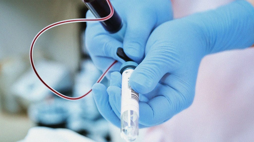 Asistenta medicală injectând sânge dintr-o seringă într-o eprubetă pentru examinare