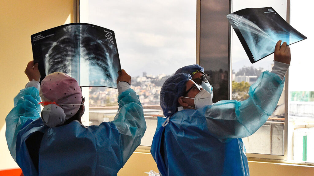 Wissenschaftler untersuchen Röntgenaufnahmen der Lunge