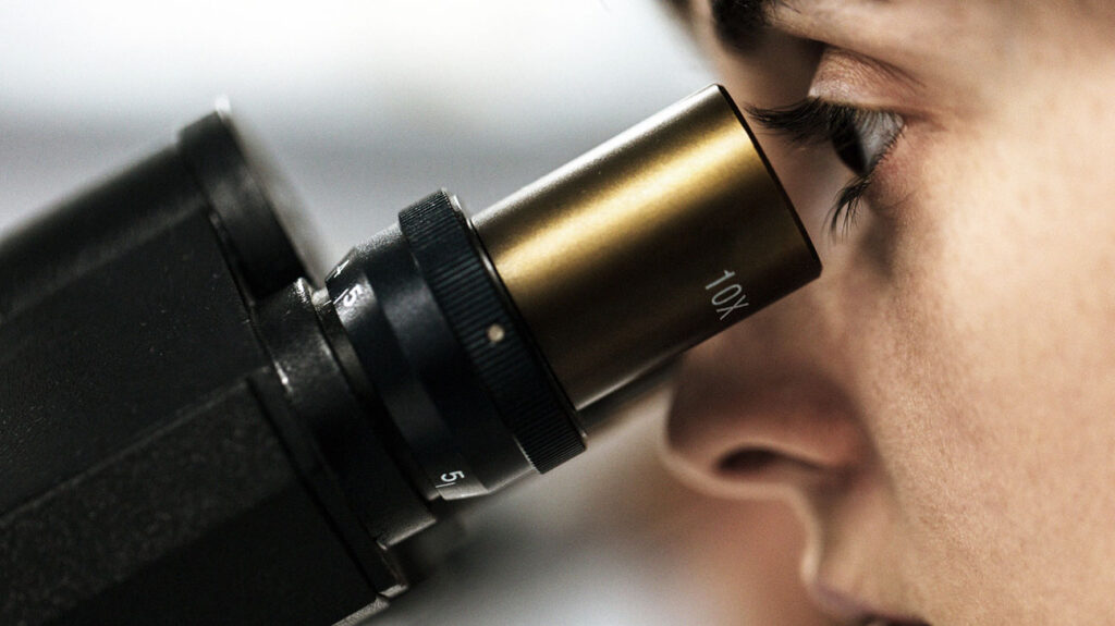 Teadlane, kes uurib mikroskoopi, et jälgida kasvajarakke